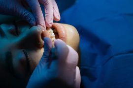 Traiter l'apnée du sommeil avec l'orthodontie